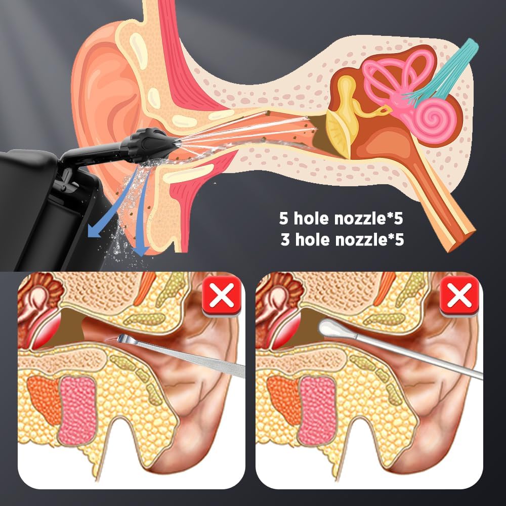 EasiWax Remover™ -Electrical Earwax Removal Kit